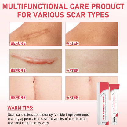Scar Soothing Cream & Smoothing Cream for Scars [2 PCS]